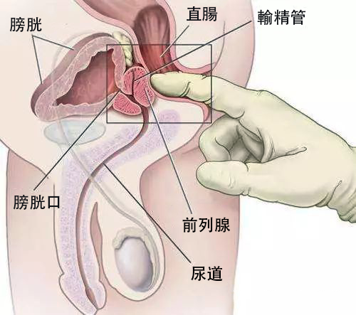 前列腺